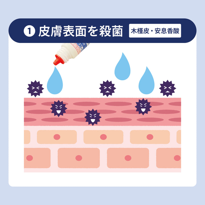 ドキンピ水虫液