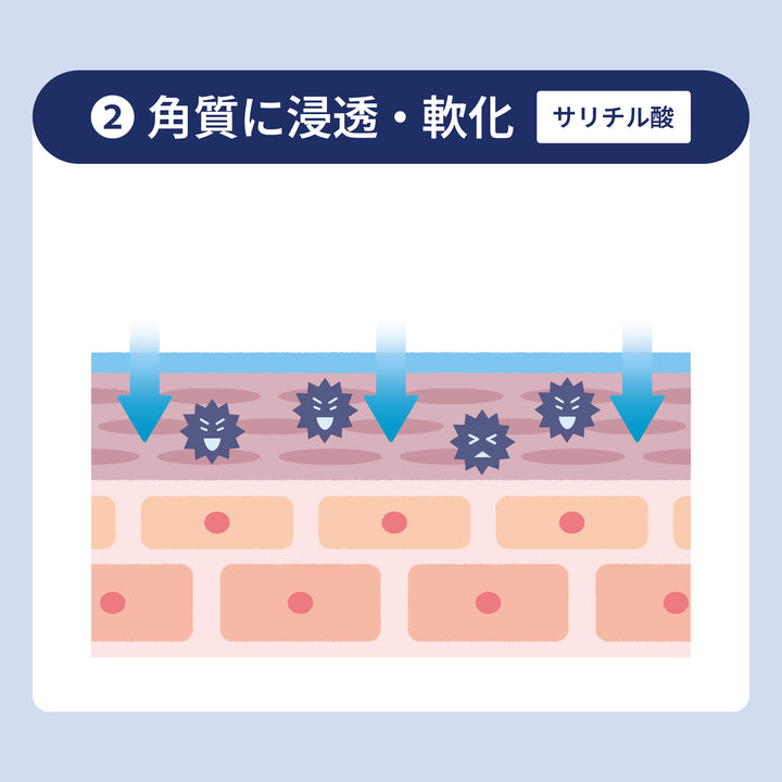 ドキンピ水虫液